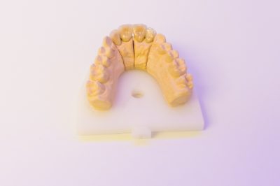 Ordinacija Dentalne medicine Dražen Kinkela | Rijeka | Hrvatska - galerija fotografija