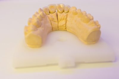 Ordinacija Dentalne medicine Dražen Kinkela | Rijeka | Hrvatska - galerija fotografija