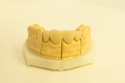 Ordinacija Dentalne medicine Dražen Kinkela | Rijeka | Hrvatska - galerija fotografija